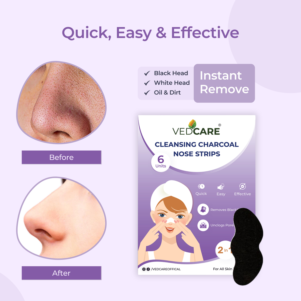 Vedcare cleansing charcoal nose strips packaging with before and after effects on a purple background