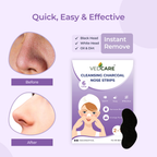 Vedcare cleansing charcoal nose strips packaging with before and after effects on a purple background